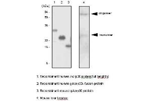 The recombinant proteins and mouse liver lysates were resolved by SDS-PAGE, transferred to PVDF membrane and probed with anti-human adiponectin antibody (1:500). (ADIPOQ antibody  (AA 15-244))