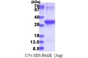 SDS-PAGE (SDS) image for Anthrax Toxin Receptor 2 (ANTXR2) (AA 34-317) protein (His tag) (ABIN5853811)