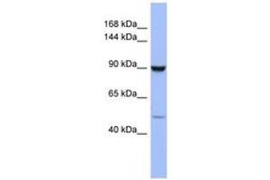 Image no. 1 for anti-Zinc Finger Protein 28 (ZFP28) (AA 791-840) antibody (ABIN6742858) (ZFP28 antibody  (AA 791-840))