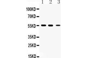 Western blot analysis of Beta III Tubulin expression in rat brian extract ( Lane 1), mouse brain extract ( Lane 2) and HELA whole cell lysates ( Lane 3). (TUBB3 antibody  (C-Term))