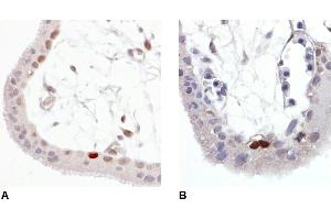 Immunohistochemistry (Paraffin-embedded Sections) (IHC (p)) image for anti-Tumor Protein P53 (TP53) (pSer392) antibody (ABIN94450)