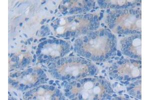 DAB staining on IHC-P; Samples: Rat Small intestine Tissue (STAP1 antibody  (AA 1-297))