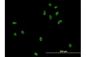 Immunofluorescence of monoclonal antibody to CSE1L on HeLa cell. (Exportin 2 antibody  (AA 872-971))