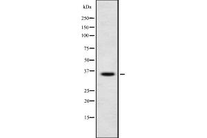 Western blot analysis OR4D9 using HeLa whole cell lysates (Olfactory Receptor, Family 4, Subfamily D, Member 9 (OR4D9) antibody)