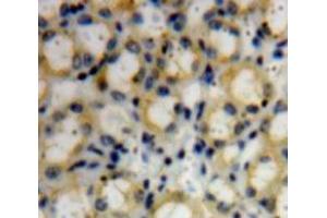 Used in DAB staining on fromalin fixed paraffin-embedded Kidney tissue (COL4a3 antibody  (AA 1428-1670))