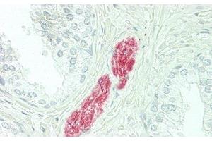 Detection of CFD in Human Prostate Tissue using Polyclonal Antibody to Complement Factor D (CFD) (Adipsin antibody  (AA 1-253))