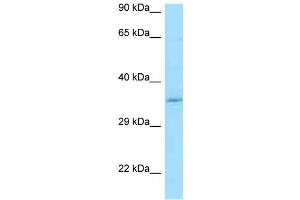 WB Suggested Anti-CCDC117 Antibody Titration: 1. (CCDC117 antibody  (Middle Region))