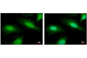 ICC/IF Image PSMF1 antibody [C2C3], C-term detects PSMF1 protein at Cytoplasm and Nucleus by immunofluorescent analysis. (PSMF1 antibody  (C-Term))