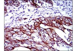 Immunohistochemistry (IHC) image for anti-Keratin 5 (KRT5) antibody (ABIN1845565) (Cytokeratin 5 antibody)