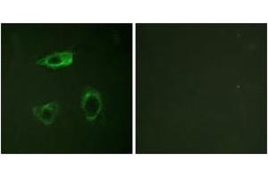 Immunofluorescence analysis of HepG2 cells, using CD18/ITGB2 (Phospho-Thr758) Antibody.
