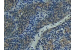 Immunohistochemistry (IHC) image for anti-Fas Ligand (TNF Superfamily, Member 6) (FASL) (AA 100-278) antibody (ABIN7430471)