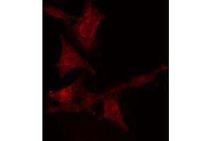 ABIN6275547 staining  Hela cells by IF/ICC. (PPP2R5D antibody  (C-Term))