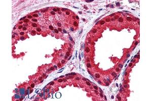 Immunohistochemistry (IHC) image for anti-Parkinson Protein 7 (PARK7) (C-Term) antibody (ABIN184951)
