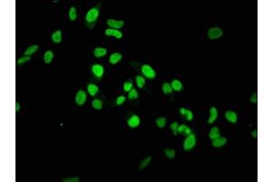 Immunofluorescence staining of Hela cells with ABIN7127301 at 1:37. (Recombinant HIST1H3A antibody  (H3K36me))