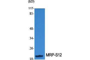 Western Blotting (WB) image for anti-Mitochondrial Ribosomal Protein S34 (MRPS34) (Internal Region) antibody (ABIN3176123) (MRPS34 antibody  (Internal Region))
