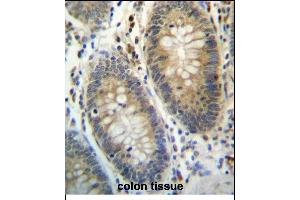 TE Antibody (C-term) (ABIN657175 and ABIN2846306) immunohistochemistry analysis in formalin fixed and paraffin embedded human colon tissue followed by peroxidase conjugation of the secondary antibody and DAB staining. (TEX261 antibody  (C-Term))