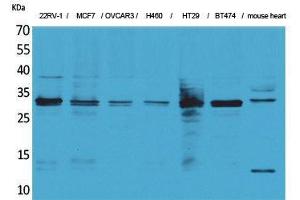 Western Blotting (WB) image for anti-Latexin (LXN) (Internal Region) antibody (ABIN3178165) (Latexin antibody  (Internal Region))