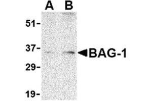 Image no. 1 for anti-BCL2-Associated Athanogene (BAG1) (N-Term) antibody (ABIN318740) (BAG1 antibody  (N-Term))