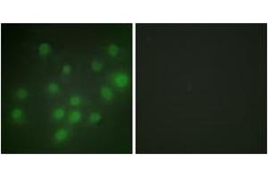 Immunofluorescence analysis of HuvEc cells, using HKR1 Antibody. (HKR1 antibody  (AA 141-190))