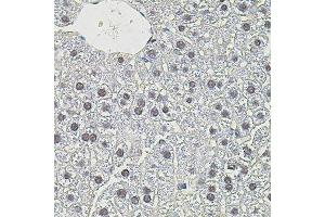 Immunohistochemistry of paraffin-embedded mouse liver using MYC antibody. (c-MYC antibody)