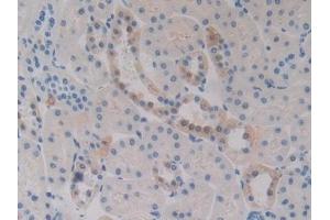 Detection of FcaR in Rat Kidney Tissue using Polyclonal Antibody to Fc Fragment Of IgA Receptor (FcaR) (FCAR antibody  (AA 51-280))