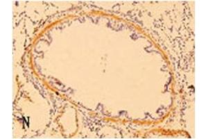 Immunohistochemistry image of ß-Defensin 3 staining in paraffn section of rat lung tissue.