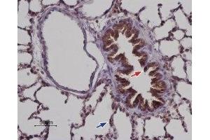 Expression of STIM2 in rat lung - Immunohistochemical staining of paraffin embedded rat lung sections using Anti-STIM2 Antibody (ABIN7043782, ABIN7044028 and ABIN7044029), (1:100). (Stim2 antibody  (C-Term, Intracellular))