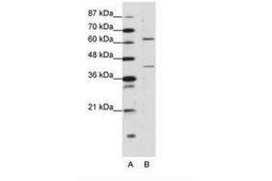 Image no. 1 for anti-Forkhead Box P4 (FOXP4) (C-Term) antibody (ABIN203239) (FOXP4 antibody  (C-Term))