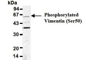 Western Blotting (WB) image for anti-Vimentin (VIM) (pSer50) antibody (ABIN1449160) (Vimentin antibody  (pSer50))