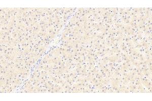 Detection of CEACAM1 in Human Liver Tissue using Polyclonal Antibody to Carcinoembryonic Antigen Related Cell Adhesion Molecule 1 (CEACAM1)