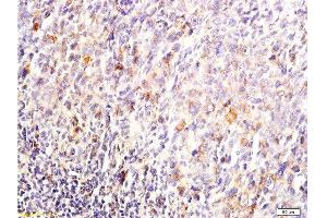 Formalin-fixed and paraffin embedded mouse lymphoma tissue labeled with Anti-DUSP1/MKP-1 Polyclonal Antibody, Unconjugated  at 1:200, followed by conjugation to the secondary antibody and DAB staining
