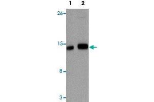Western blot analysis of IFITM1 in NIH/3T3 cell lysate with IFITM1 polyclonal antibody  at (1) 1 and (2) 2 ug/mL. (IFITM1 antibody  (Internal Region))