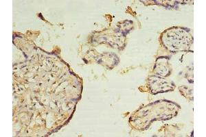 Immunohistochemistry of paraffin-embedded human placenta tissue using ABIN7176101 at dilution of 1:100 (ZMYND19 antibody  (AA 1-227))