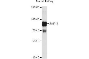 Western blot analysis of extracts of mouse kidney, using ZNF12 Antibody (ABIN6291084) at 1:3000 dilution.