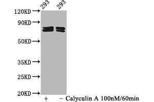 Western Blot Positive WB detected in 293 whole cell lysate(treated with Calyculin A or not) All lanes Phospho-PAK4/PAK5/PAK6 antibody at 2. (Recombinant PAK4/PAK5/PAK6 (pSer474), (pSer560), (pSer602) antibody)