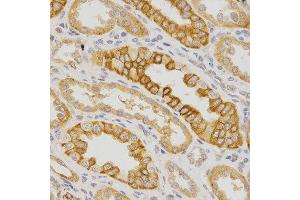 Immunohistochemistry of paraffin-embedded human kidney using IL23R antibody at dilution of 1:200 (x400 lens)