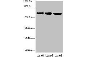 Western blot All lanes: CATSPER2 antibody at 4 μg/mL Lane 1: Jurkat whole cell lysate Lane 2: HepG2 whole cell lysate Lane 3: 293T whole cell lysate Secondary Goat polyclonal to rabbit IgG at 1/10000 dilution Predicted band size: 63, 62, 49, 24 kDa Observed band size: 63 kDa