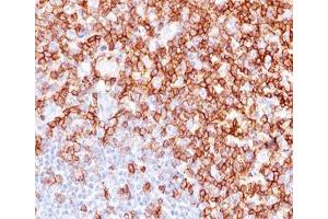 IHC testing of human tonsil stained with CD45RO antibody (UCHL-1). (CD45RO antibody)