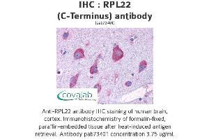 Image no. 1 for anti-Ribosomal Protein L22 (RPL22) (C-Term) antibody (ABIN1738940) (RPL22 antibody  (C-Term))