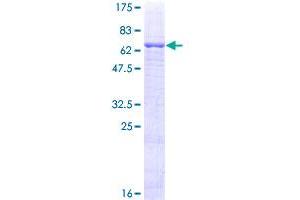 Hepsin Protein (HPN) (AA 40-417) (GST tag)