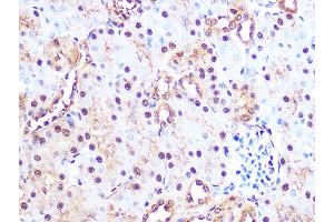 Immunohistochemistry of paraffin-embedded mouse kidney using PSM Rabbit mAb (ABIN7269600) at dilution of 1:100 (40x lens). (PSMA3 antibody)