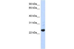 WB Suggested Anti-C21orf56 Antibody Titration:  0. (C21ORF56 antibody  (N-Term))