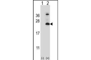Western blot analysis of TSN6 (arrow) using rabbit polyclonal TSN6 Antibody (C-term) (ABIN6242668 and ABIN6579053). (Tetraspanin 6 antibody  (C-Term))