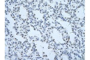 Rabbit Anti-THOC1 Antibody       Paraffin Embedded Tissue:  Human alveolar cell   Cellular Data:  Epithelial cells of renal tubule  Antibody Concentration:   4. (THOC1 antibody  (C-Term))