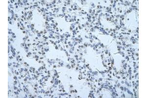 Rabbit Anti-THOC1 Antibody       Paraffin Embedded Tissue:  Human alveolar cell   Cellular Data:  Epithelial cells of renal tubule  Antibody Concentration:   4. (THOC1 antibody  (C-Term))