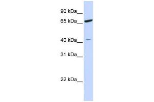 WB Suggested Anti-ZNF334 Antibody Titration: 0. (ZNF334 antibody  (N-Term))