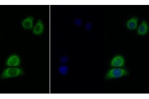 Detection of IL11Ra in Human Hela cell using Polyclonal Antibody to Interleukin 11 Receptor Alpha (IL11Ra) (IL11RA antibody  (AA 59-217))