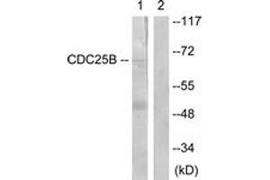 Western blot analysis of extracts from Raw264. (CDC25B antibody  (AA 319-368))