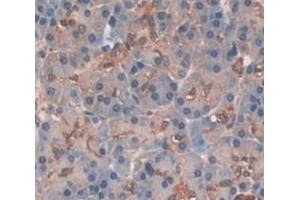 IHC-P analysis of Human Tissue, with DAB staining. (Elastase 3B antibody  (AA 29-270))