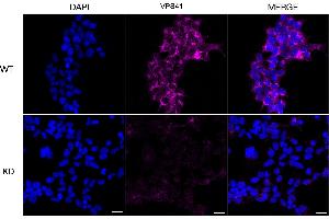 Immunocytochemical staining of HeLa cells using VPS41 antibody (ABIN7800815), 1:1,000), Top panel: wild-type (WT), Bottom panal: VPS41 shRNA knockdown (KD). (Recombinant VPS41 antibody)